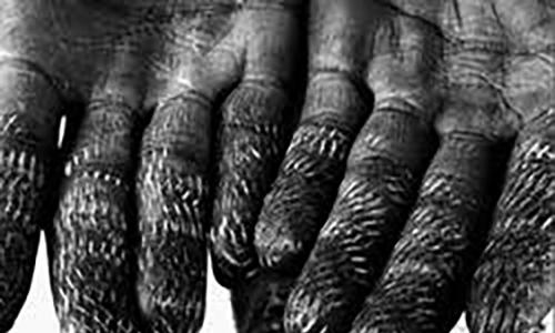 Hands